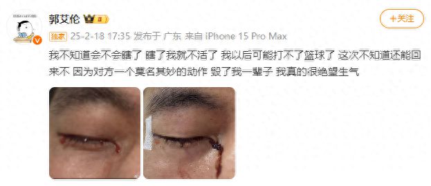 新闻多一度丨郭艾伦眼睛受伤引关注 运动时我们该如何保护双眼？